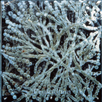 Mold Removal Testing Remediation Inspection Monmouth County NJ Middlesex County Ocean Professional Services Near Me