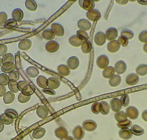 Mold Removal Testing Remediation Inspection Monmouth County NJ Middlesex County Ocean Abatement Services Companies