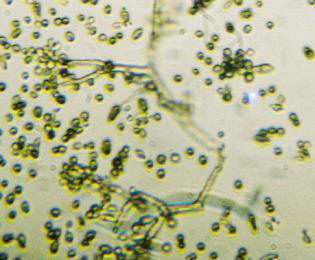 Certified Black Mold Removal Testing Remediation Inspection Monmouth County NJ Middlesex County Ocean Professional Companies