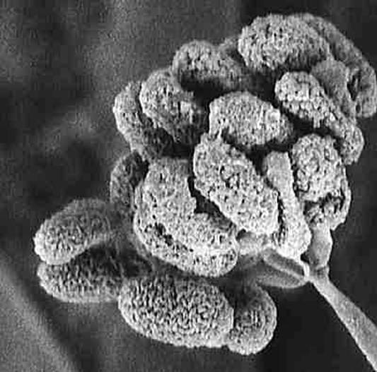 Mold Removal Companies Testing Remediation Inspection Monmouth County NJ Middlesex County Ocean Abatement Services